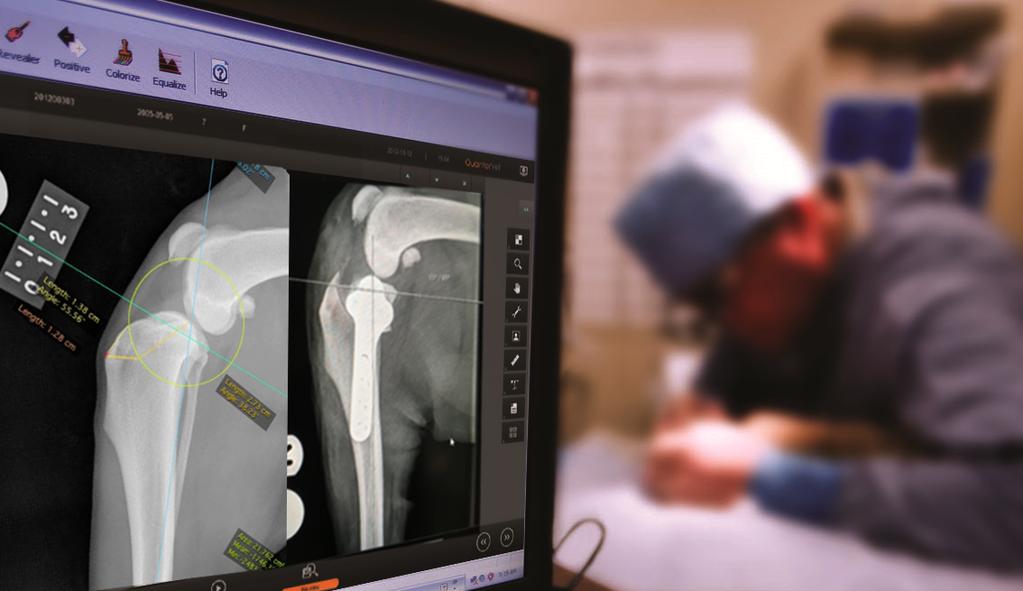 TIBIAL PLATEAU LEVELING OSTEOTOMY (TPLO) There are three main techniques for cruciate disease management: TTA surgery, TPLO surgery and the lateral suture system (LSS).