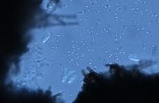 spores were observed while still attached to