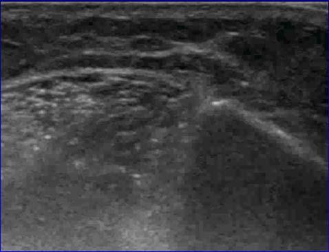 images from the textbook Fundamentals of Musculoskeletal Ultrasound