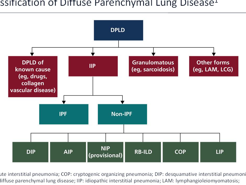 Classification of Diffuse Parenchymal Lung Disease 1 AIP: acute interstitial pneumonia; COP: cryptogenic organizing pneumonia; DIP: desquamative interstitial pneumonia; DPLD: diffuse parenchymal