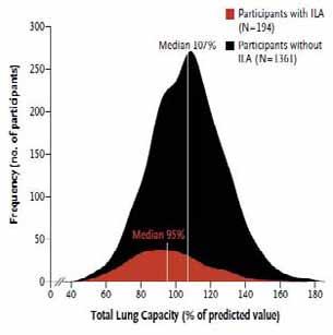 Lung volumes and emphysema in smokers with interstitial 