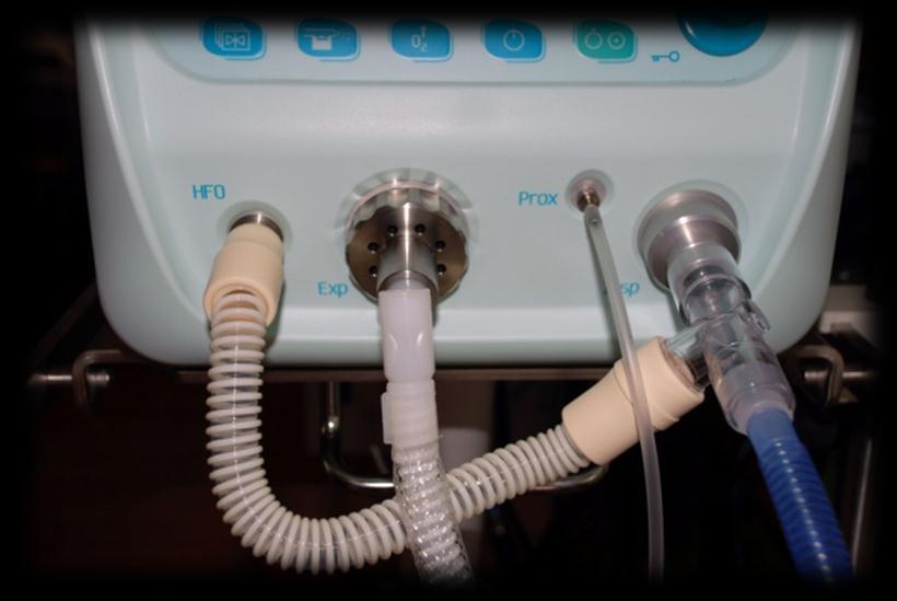 Quick guide for fabian HFO ventilator Preparations of the ventilator: Connections: (Power cord,