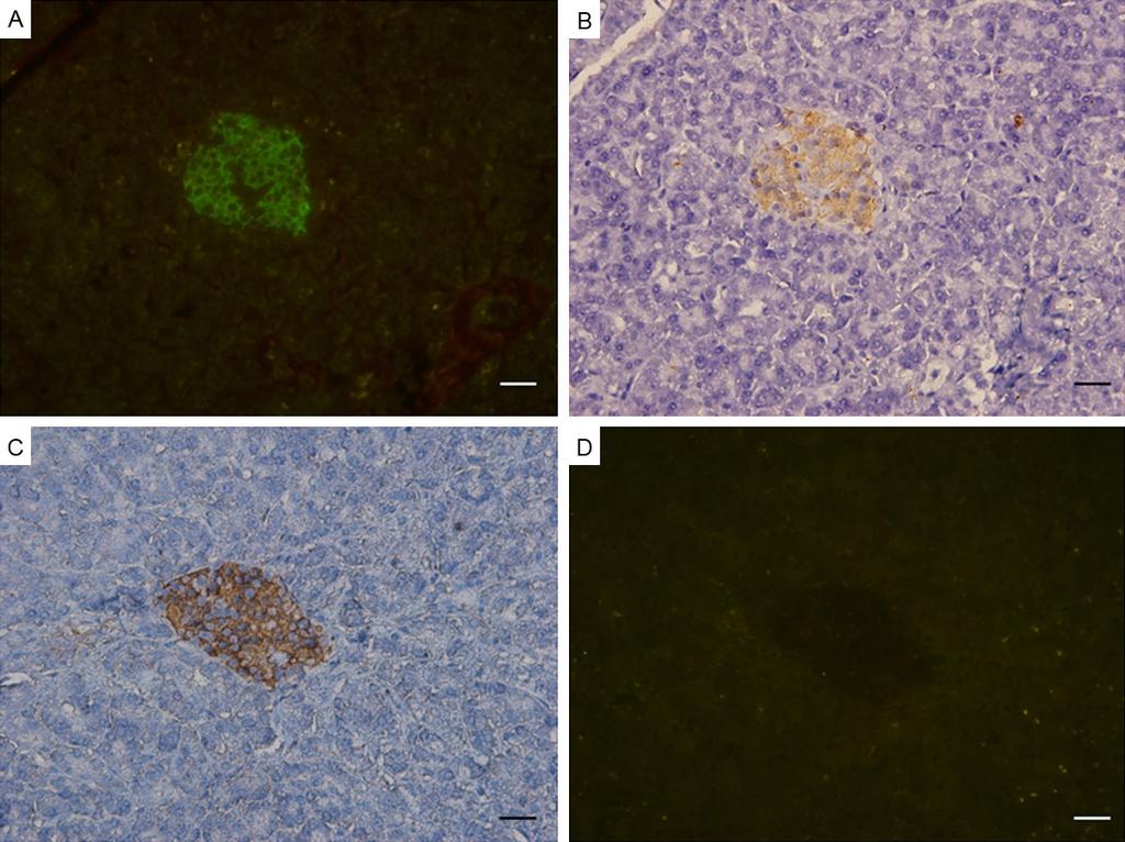 Figure 3. Representive image of IHC staining after IFF and IFF staining after IHC with the rabbit anti-human insulin on human pancreatic TMA.