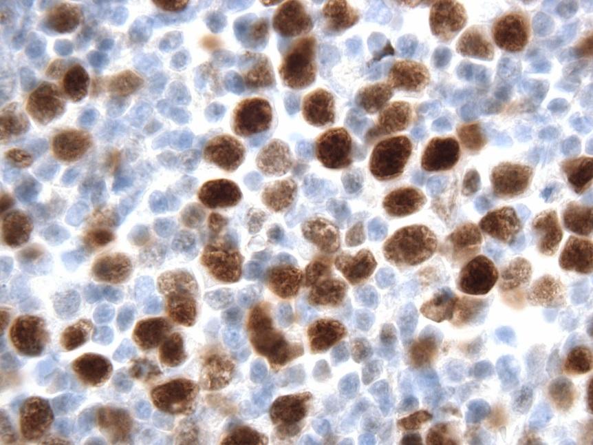 Immunohistochemistry Allows for the Detection of Proteins in situ 1.