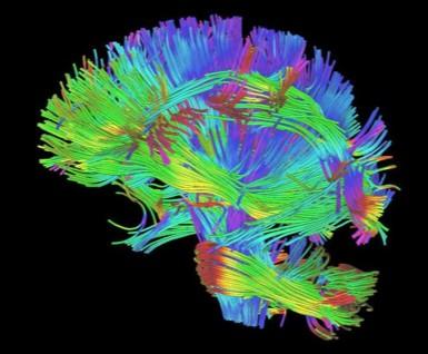 integrity of gray and white matter structures in the brain DTI: MRI-based technique to map white