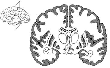 MEG - signal genesis (I) Cerebral cortex is the brain s outer layer of neural tissue in mammals Cerebral cortex is dramatically folded (sulci, gyri) In cerebral cortex neurons are: - connected