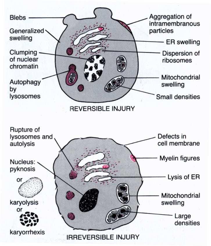 Cell injury - morphology