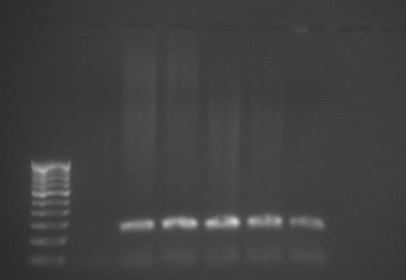 M 1 2 3 4 5 400 bp 300 bp 200 bp 100 bp 244 bp Figure 1: Amplified PCR product from