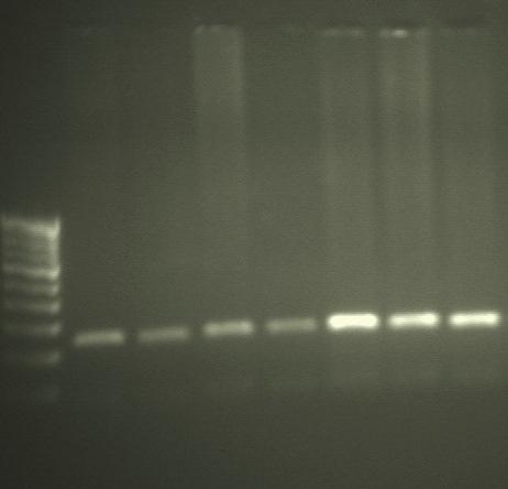 M 1 2 3 4 5 6 7 400 bp 300 bp 200 bp 100 bp 244 bp 223 bp Figure 2: PCR-RFLP of Pro12Ala SNP using BstU1 restriction enzyme.