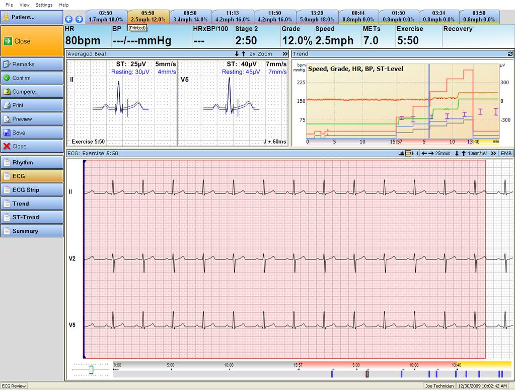 Display a Stress Test ECG Record 1 4 2 3 2 3 4 Figure 10-1: Example of ECG views 1 ECG strip panel ECG strip reflects