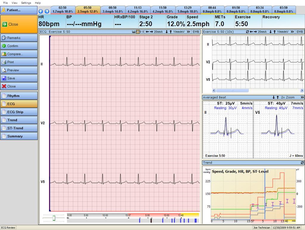 left) 3 Trend panel The actual time is synchronized in the trend window, in the average beat rate and in the ECG window