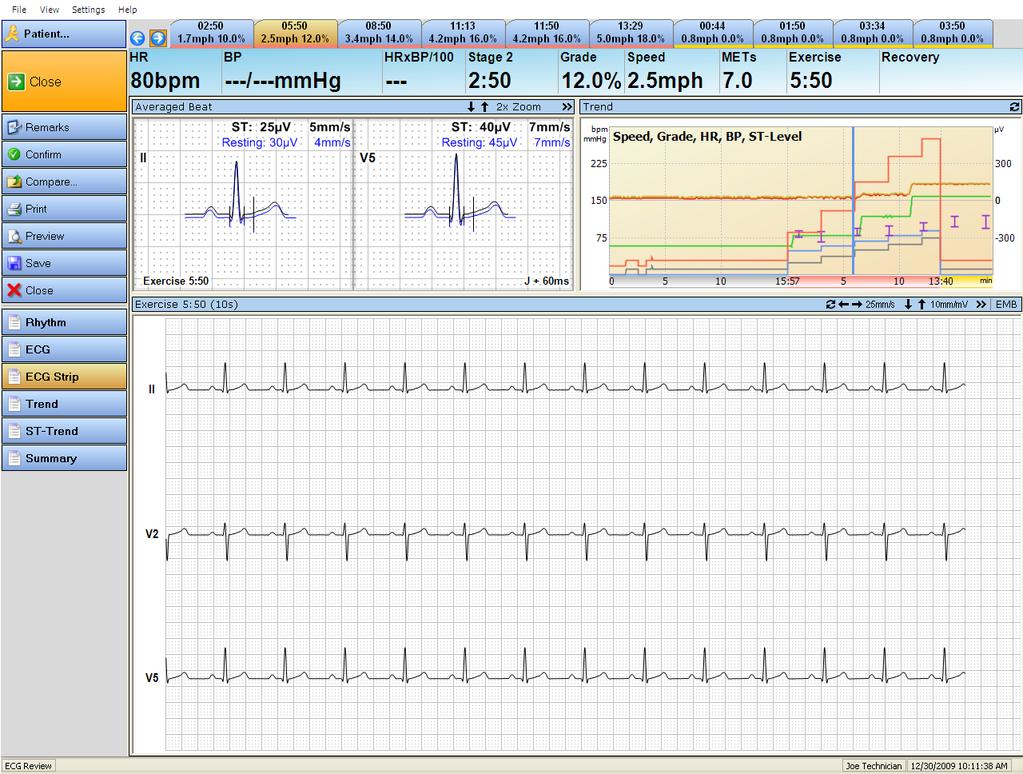 ECG strip view ECG strip view 1 2 3 Figure 10-3: Example of ECG Strip view 1 Using the arrow buttons, you can see the sections (strips) one after the other 2 By clicking the tab you can open to the