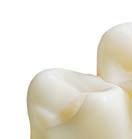 There are many reasons: First of all, Lava is a leading brand in more than 40 countries; it stands for excellent and highly aesthetic zirconia restorations.