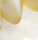 STRENGTH FIT AESTHETICS PROVEN BY CLINICAL STUDIES An additional choice to perfection: Lava All-Zirconia Monolithic.