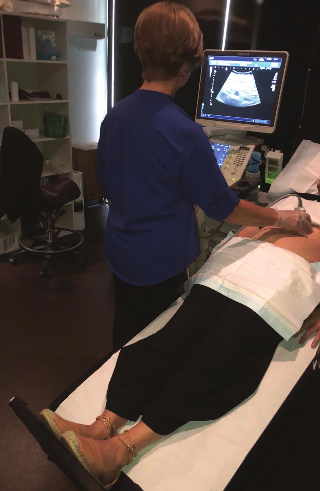 Our Protocol for Transabdominal Pelvic Vein Duplex Ultrasound A summary of s protocol for pelvic vein duplex ultrasonography, including equipment, patient positioning, ultrasound settings, and
