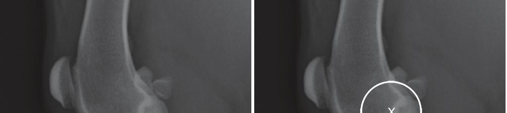 Tibial Tuberosity Advancement: A step-by-step approach to using the Common Tangent Method for determining advancement in cranial cruciate deficient