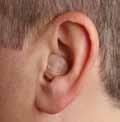 In-The-Ear (ITE) Easy to adjust For mild to severe hearing loss Custom-made for you Receiver-In-Canal (RIC) Comfortable open