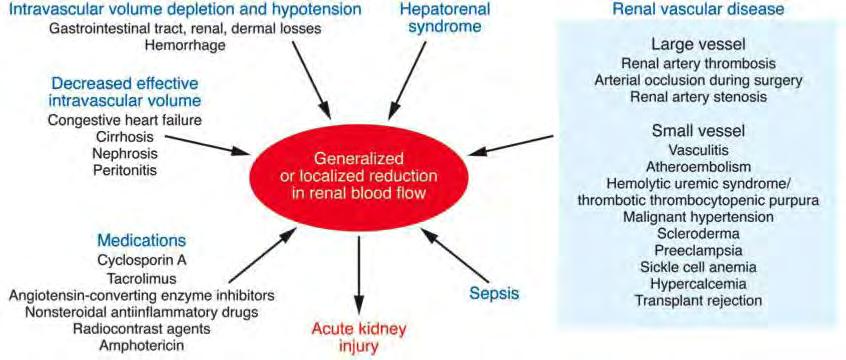 Causes of decreased regional blood flow in