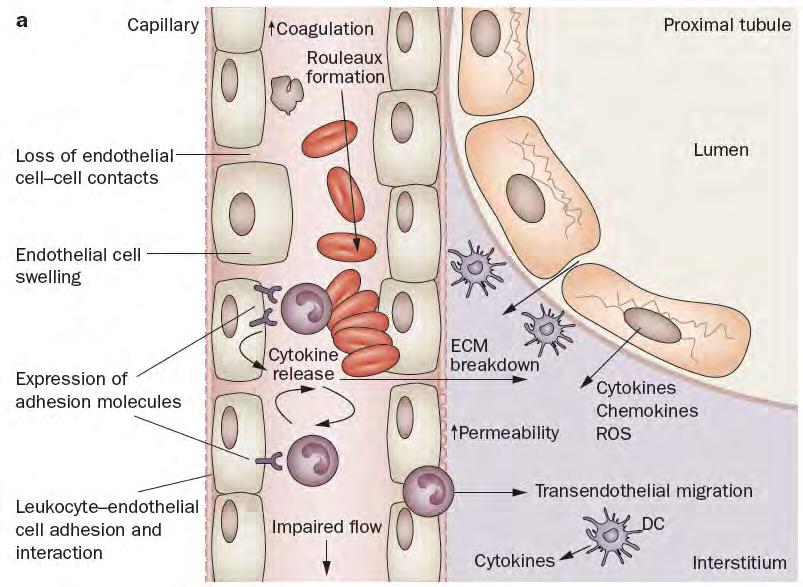 Endothelial Cell Injury in AKI Endothelial cell ac8va8on Upregula8on of adhesion molecules expression of endothelial protein C receptor and thrombomodulin endothelial