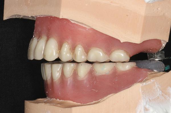 operator-guided recording method. The little finger is placed behind the angle of the mandible with the other four fingers positioned on the lower border of the mandible.