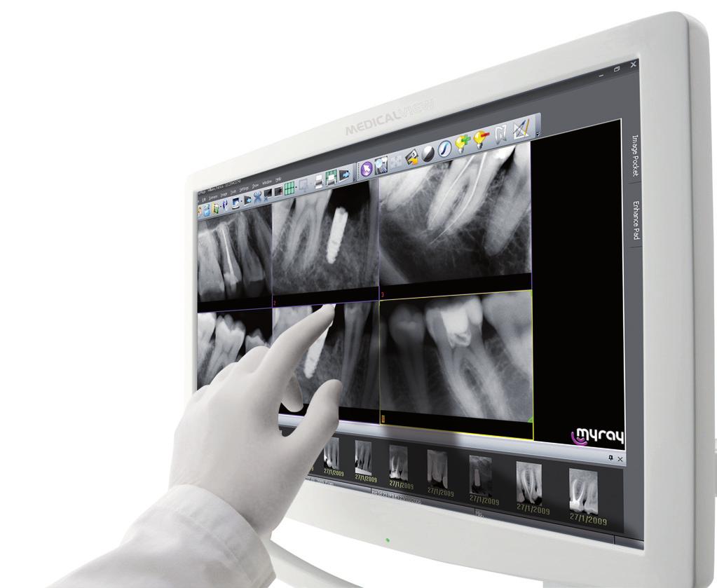 final outcome of treatment. Consisting of an intraoral camera and a flat-screen monitor, the system can be used by either dentist or assistant.