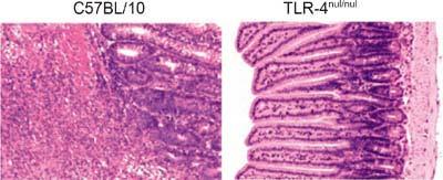 TLR inhibition protects against TH1-mediated colitis Mechanism Toxic damage (IEC, T cell etc.