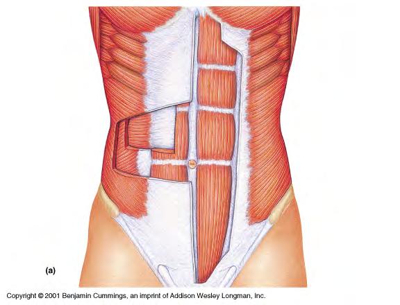 87 The transversus abdominis is a deep muscle (since