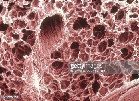 Respiratory System - Alveoli The