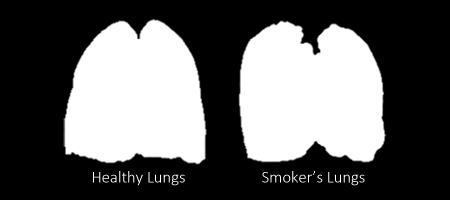 smoking-related diseases like lung cancer, heart disease, and