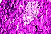 orally at a dose of 200mg/kg, islets resemble normal rat islets and glibenclamide