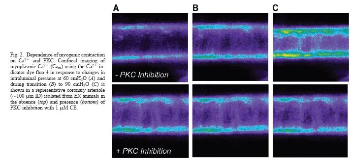 Results Dependence of myogenic response to changing transmural pressure on PKC: Inhibition of PKC with chelelythrine decreased myogenic tone in both sedentary and active pigs, but CE had an increased