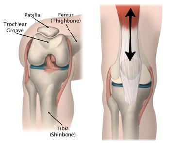 Within the patellofemoral compartment, the patella lies in a groove on the top of the femur called the trochlea.