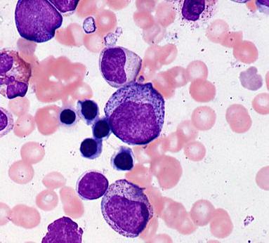 promyelocyte Azurophilic granules first appear in less mature neutrophils called promyelocytes.