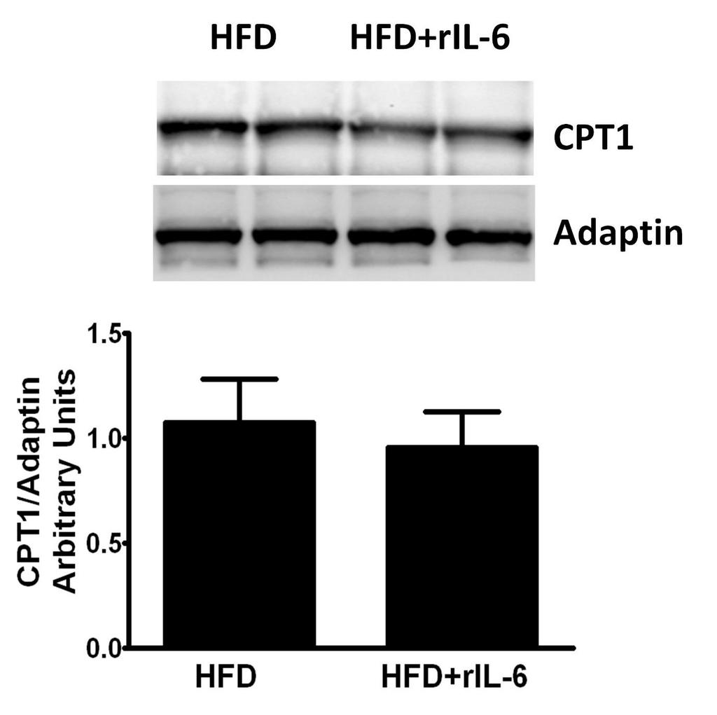 Figure S3. Effect of ril-6 treatment on the hepatic CPT1 protein expression in IL-6 -/- mice fed HFD.