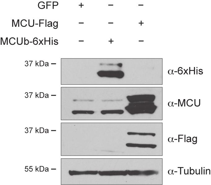 Supplementary Figure 8 Supplementary Figure 8. MCUb overexpression does not alter MCU protein levels. HeLa cells were infected with the indicated adenoviruses.