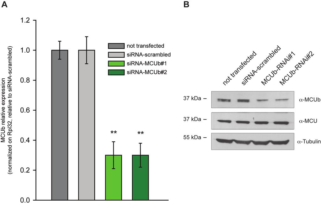 Supplementary Figure 5 Supplementary Figure 5. Effect of two different MCUb sirnas on (A) MCUb mrna and (B) MCUb protein level. MCUb was silenced using two different sirna.