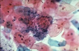 cytological preparations is