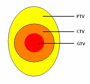 cancerous (1). The PTV consists of the CTV with an additional margin to account for uncertainties due to motion and patient setup (1).
