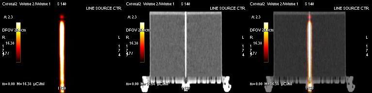 Figure 4.1: Three coronal images of the line source used to determine the transaxial resolution of the PET scanner.