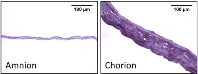 Dehydrated Human Amnion Chorion Membrane (dhacm) Preserves: Extracellular Matrix Structurally intact tissue