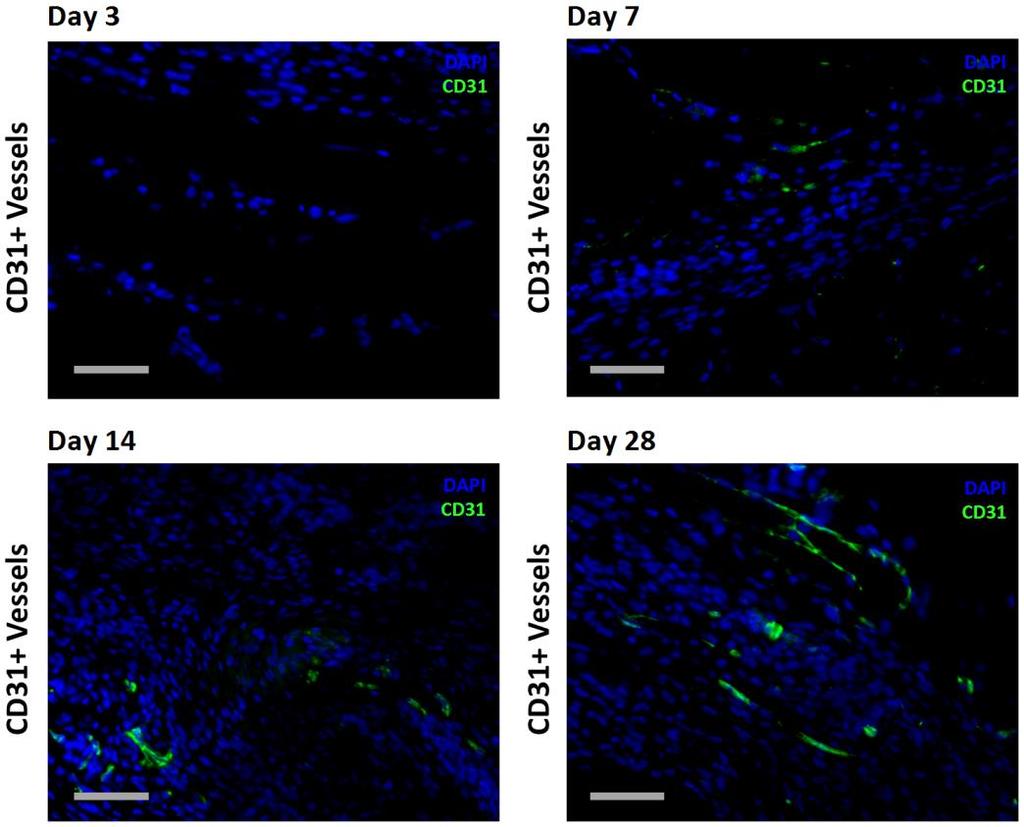 Promotion of Angiogenesis within the dhacm Graft in an Ischemic in vivo Model Adapted from Koob TJ, Lim JJ, Massee M, Zabek N, Rennert R, Gurtner G, Li WW.