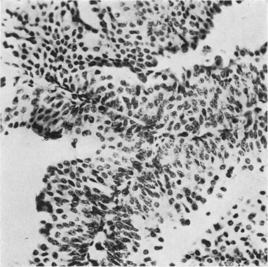 Fig. 1. Papilloma (cow).