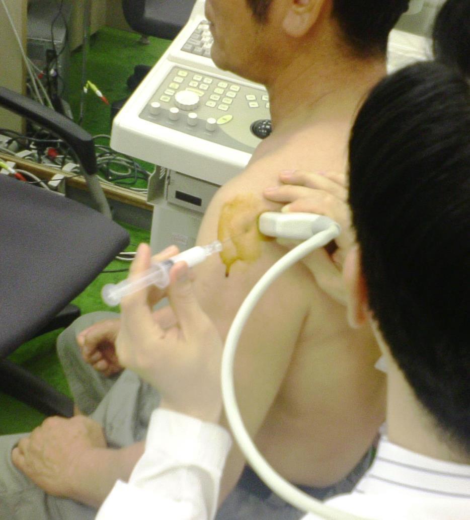 Glenohumeral Joint Intra-articular Injection Position yourself to view both the injection
