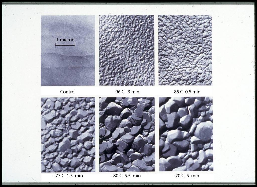 Electron micrographs by Dr. Harry T.