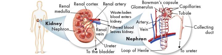 Kidney Disorders Kidney Damage Excessive blood pressure damages the delicate filtering mechanism, and high blood sugar causes the