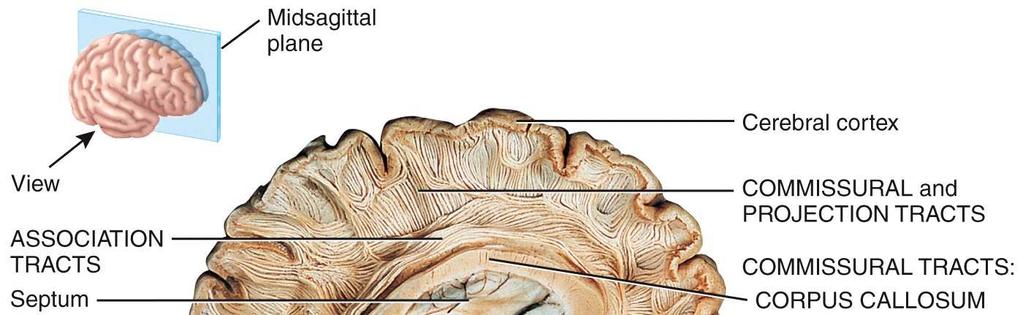 the: Frontal lobe Parietal lobe