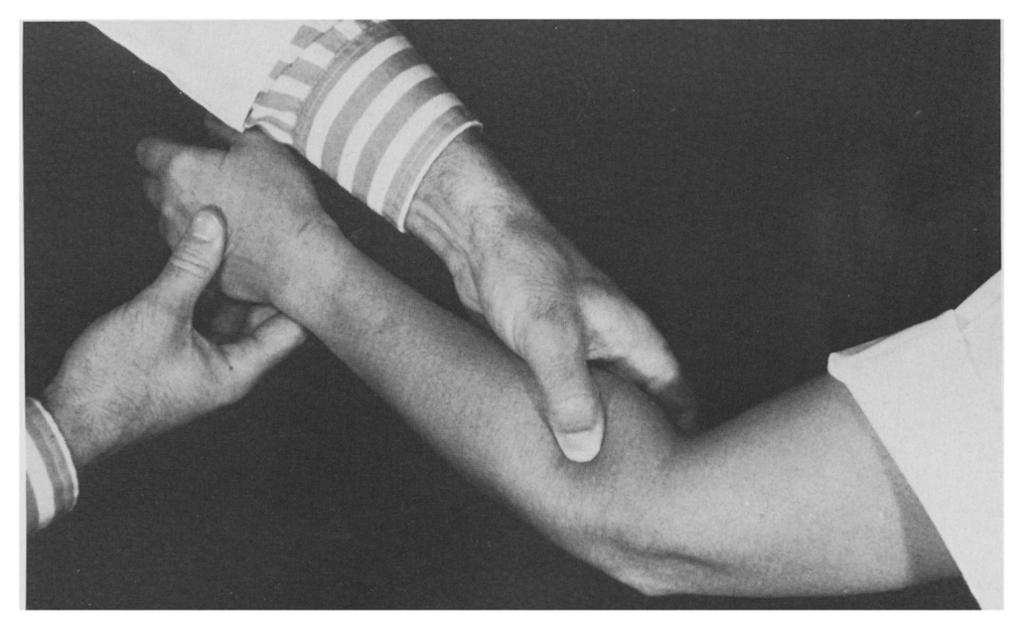 3 and in resisted supination of the extended forearm, is referred to this point. (rom Lister GD: The hand: Diagnosis and indications. by permission of the publishers. Churchill-Livingstone, Ltd.