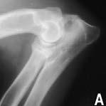 Ulnar Osteotomy/Ostectomy! Outcome:! Variable with this technique alone! Dependent on:! Dog age less likely to observe fusion if dog is > 6-7 months of age at time of surgery!