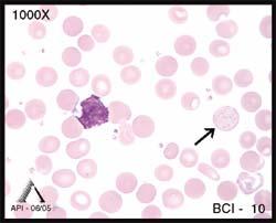The nuclear chromatin is clumped, condensed, and appears a deep purple. Nucleoli may sometimes be present, but are often not visible. BCI-10 illustrates an erythrocyte with basophilic stippling.