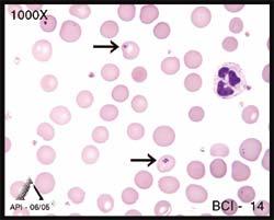 Image BCI-14 shows 2 erythrocytes with Pappenheimer bodies. Pappenheimer bodies contain iron. They are small and shaped irregularly.